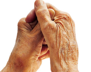 Rheumatoid Arthritis: Best and Worst Supplements and Herbs