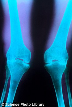 Grow your own tissues to mend arthritic knees